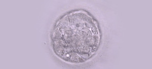 This is our Day 5 embryo